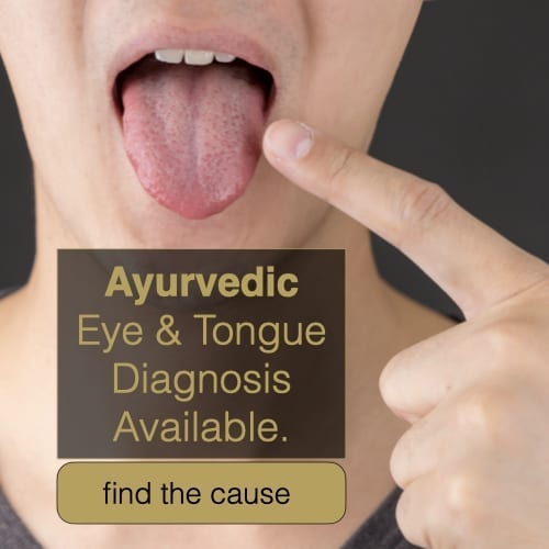 Ayurvedic Tongue Diagnosis - Ayurvedic Therapists