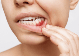 Ayurvedic Oral Health Protocol -